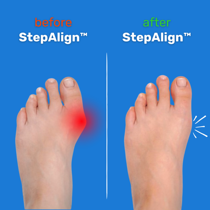 StepAlign™