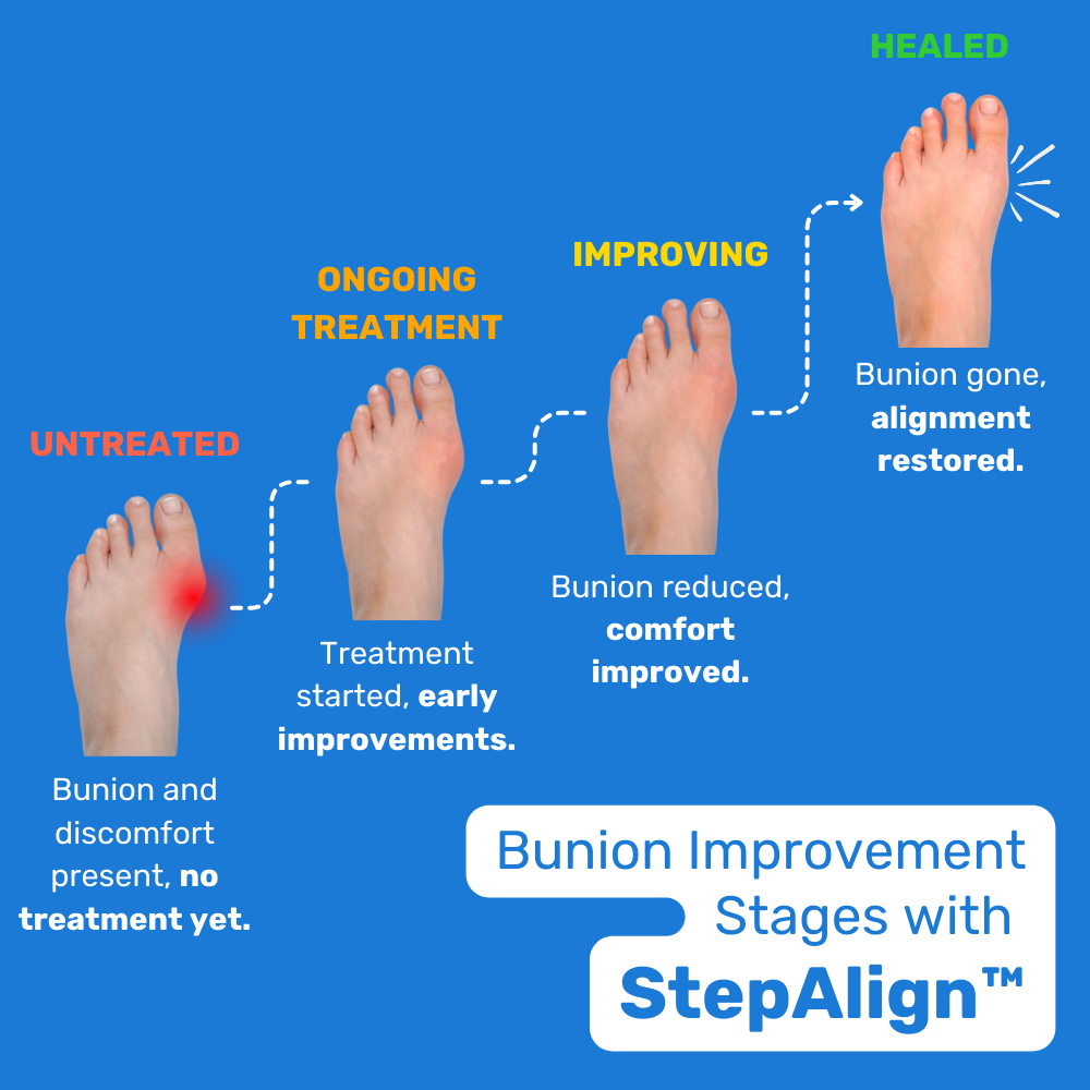 StepAlign™